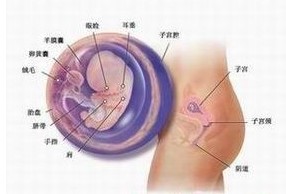 宫内早孕是什么意思