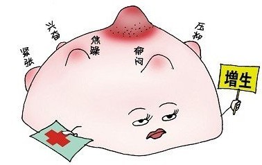 乳腺增生伴瘤化
